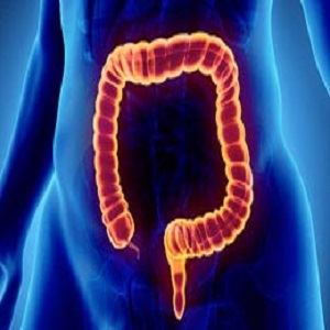 Colonoscopy and Endoscopy Center NYC