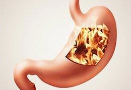 Colonoscopy and Endoscopy Center NYC